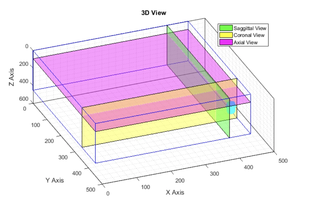 Interfaz de Implant Viewer: posicionamiento del implante sobre los planos axial, sagital y coronal